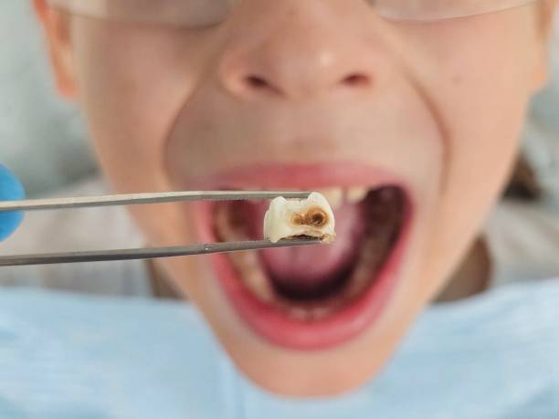 Best Dentist for Dental Trauma  in Newfoundland, NJ