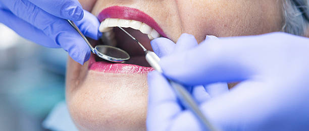 Best Chipped Tooth Repair Near Me  in Newfoundland, NJ